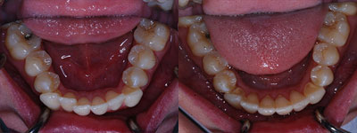after image